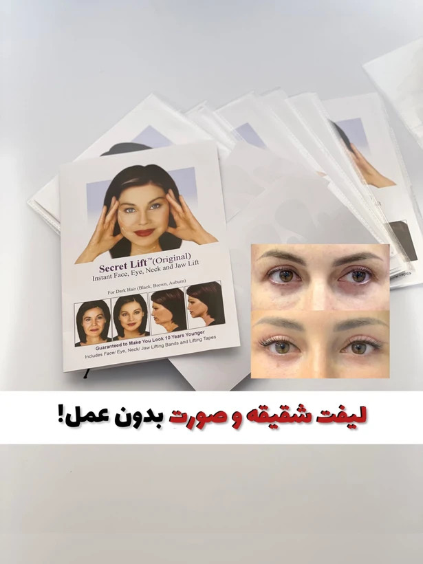 چسب لیفت شقیقه