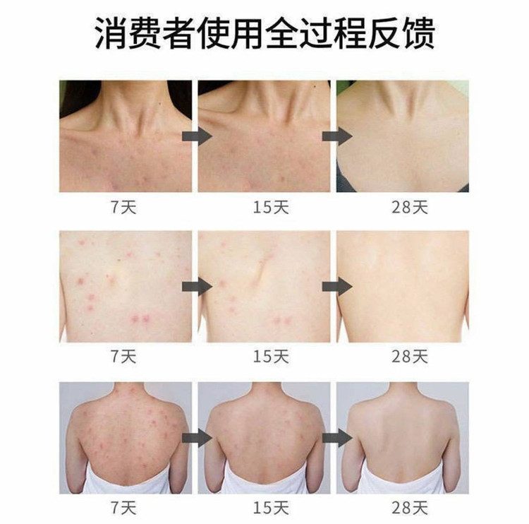 اسپری ضدجوش بدن سیازو