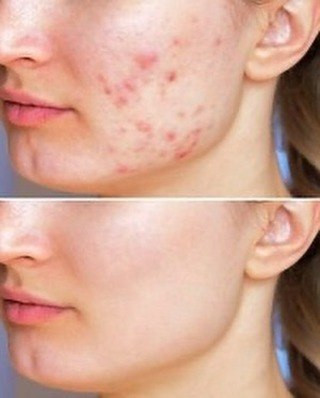 صابون گلوتاتیون