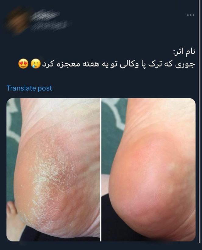کرم ترک پا